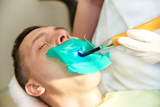 Dentist performing bonding procedure on a tooth